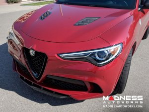 Alfa Romeo Stelvio Hood Air Vent Trim Kit - Quadrifoglio - Carbon Fiber Alfa Romeo Stelvio Hood Air Vent Trim Kit - Quadrifoglio - Carbon Fiber